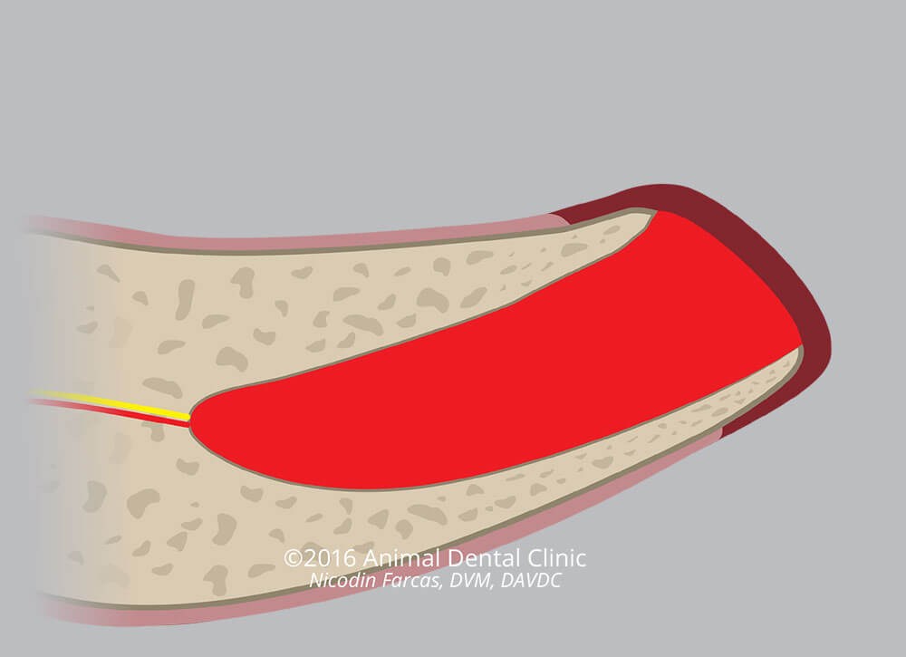 14. Post Root Extraction