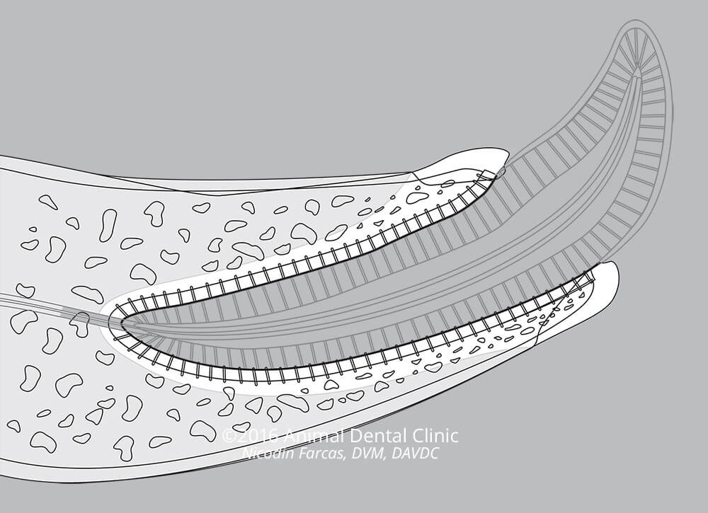 25. Periodontal Base Wires: Mandible