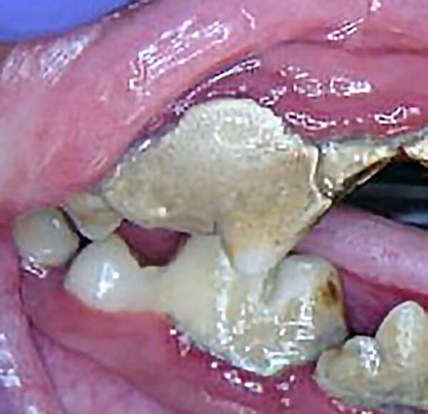 Animal Dental Clinic: calculus-mineral-deposits Animal Dental Clinic: calculus-mineral-deposits