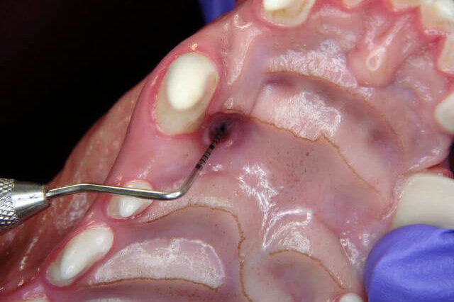 Animal Dental Clinic: exploring-the-oronasal-fistula-caused-by-malocclusion