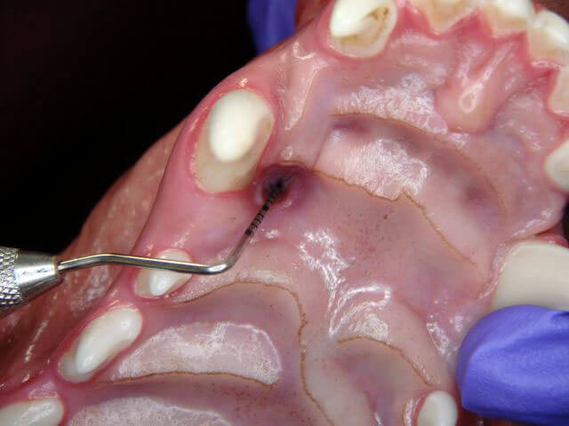 Animal Dental Clinic: exploring-the-oronasal-fistula-caused-by-malocclusion Animal Dental Clinic: exploring-the-oronasal-fistula-caused-by-malocclusion