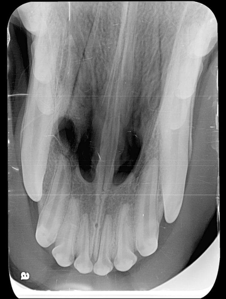 Animal Dental Clinic: radiographing-the-oronasal-fistula Animal Dental Clinic: radiographing-the-oronasal-fistula
