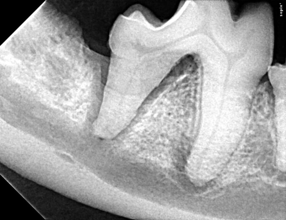 Animal Dental Clinic: radiograph-perio-diagnosis Animal Dental Clinic: radiograph-perio-diagnosis