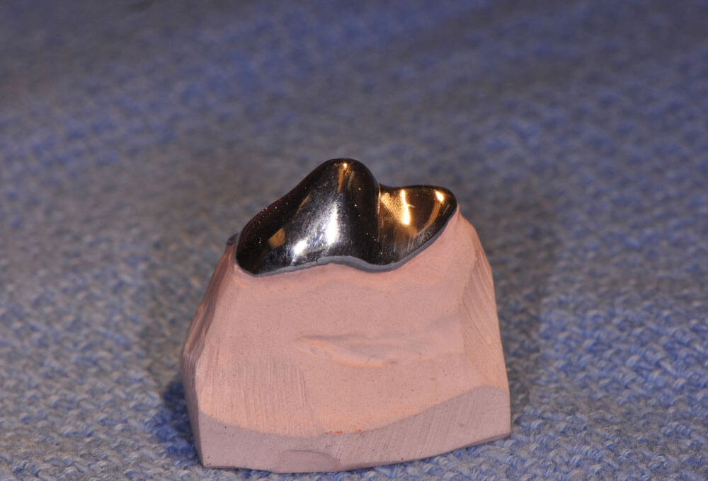 Metal Crown