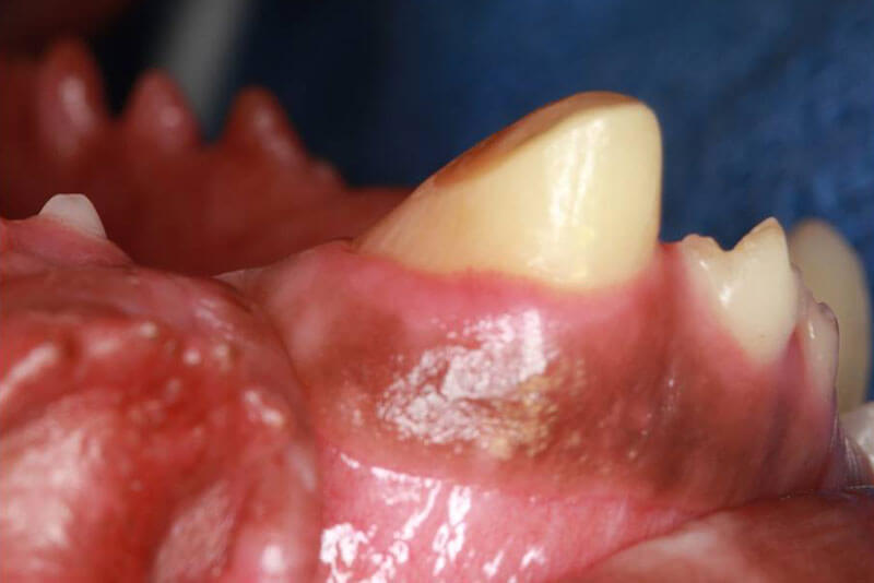 RCT Completed Clinical